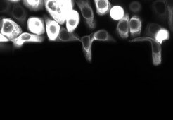 Deformation of pancreas tumor cells at the migration through small channels