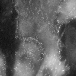 Fibroblast cells (REF) stained with YFP paxillin Normal mode
