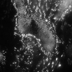 Fibroblast cells (REF) stained with YFP paxillin TIRF mode
