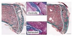 Masson-Goldner Färbung von Knochenschnitten. Die behandelten Tiere weisen wesentlich weniger Osteoid auf als die Kontrollen (Ausschnitte). Der Pfeil im Bildausschnitt zeigt dunkel Rosa gefärbtes Osteoid (Kontrolle). Die Balken repräsentieren 500 µm.