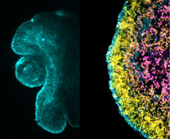 Fluorescence image of retina organoid. The retina organoid develops a typical tissue morphology (left: day 8 organoid; cyan actin-gap) and cell types which are organised into distinct layers (right: day 24 organoid; cyan rx-gfp, yellow DAPI, magenta pax6-AF594)