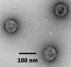 Negative stain electron micrograph of mavirus. Image by U. Mersdorf.