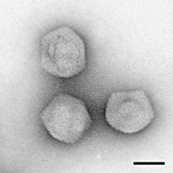 Recombinant Mavirus like particles. (Scale: 50 nm)