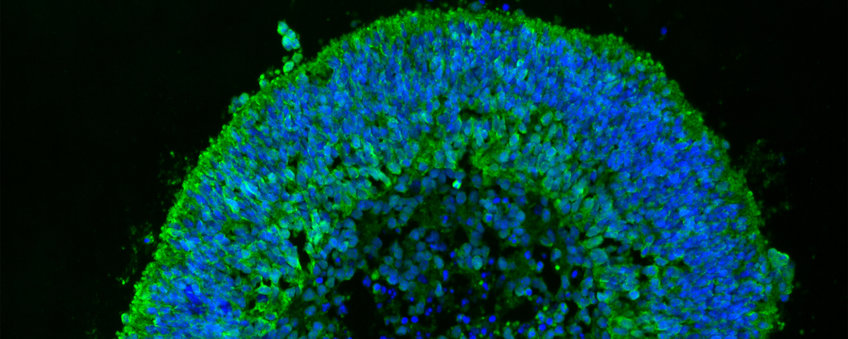 Chemical Synthesis of Organoids