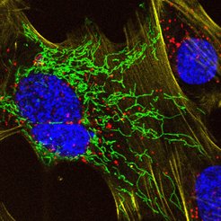 Live cells incubated with four different probes and imaged directly without any washing steps.