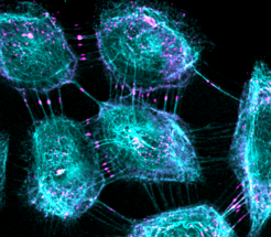 Fluorescence microscopy image of adherens juctions.