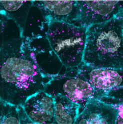 Human skin cells cultures (gray and cyan) are reprogrammed by the uptake of synthetic exosomes (purple).