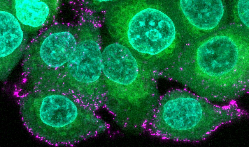 Human epithelial cells (green with blue nuclei) are incubated with synthetic SARS-CoV-2 virions (magenta) to study the initial of infection and immune evasion. 