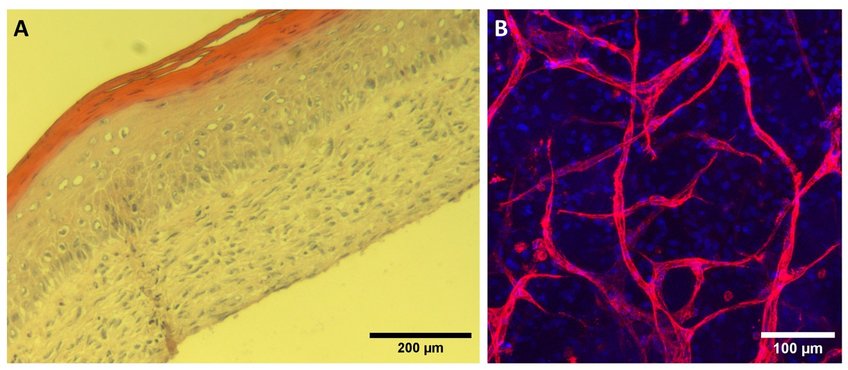 Fig. 3. Scaffold-free in-vitro skin models A) H&amp;E staining of cryo-sectioned full-thickness human skin model depicting differentiated epidermis with visible cornification B) Confocal image of blood vessels (red, CD31 stained) in the fabricated vascularized skin models (Blue, DAPI stain). 