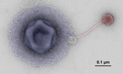 False-color electron micrograph of a giant virus (blue) and a bacteriophage (red) from an Alpine lake.