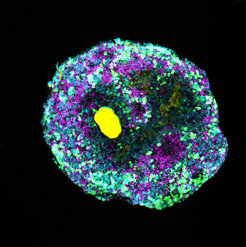 Netzhautorganoid mit mikroskopisch kleiner Kugel aus DNA (gelb) und verschiedenen retinalen Zelltypen (grün, zyan, magenta).