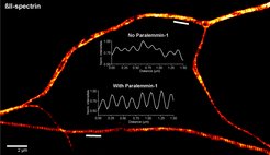 The expression levels of paralemmin-1 are crucial for controlling the nanoscale organization of the MPS: While the absence of paralemnin-1 results in a poorly organized MPS (top axon), high levels of paralemmin-1 lead to an extremely tight periodic arrangement (bottom axon).