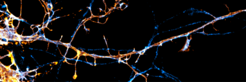 Das Protein Paralemmin-1 ist ein starker Regulator des Submembran-Zytoskeletts in Neuronen, das als membranassoziiertes periodisches Skelett (MPS) bekannt ist.