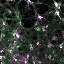 New molecular recorder called Kinprola (green) with split Halotag (magenta) for recording and investigating kinase activities