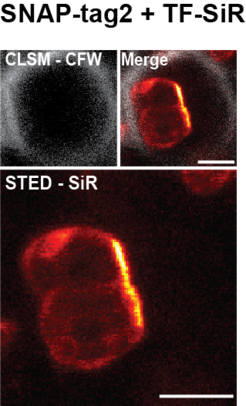 SNAP-tag2 also enables efficient labeling in yeast cells.