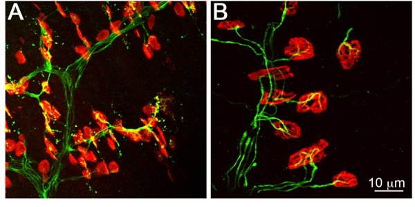 The neuromuscular junction - a model synapse The neuromuscular junction - a model synapse