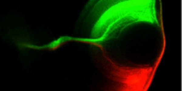 Larval zebrafish retina, double-labeled with DiO Larval zebrafish retina, double-labeled with DiO