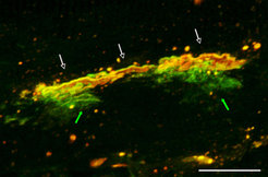 Endplatten zehn Tage nach Denervierung des Soleus-Muskels. Endplatten (weiße Pfeile) enthalten vorwiegend AChRγ-GFP, die die AChRε ersetzt haben. Die neuen AChRγ-GFP werden im subsynaptischen sarkoplasmatischen Retikulum zusammengebaut (grüne Pfeile) (Skalierung 20 μm).